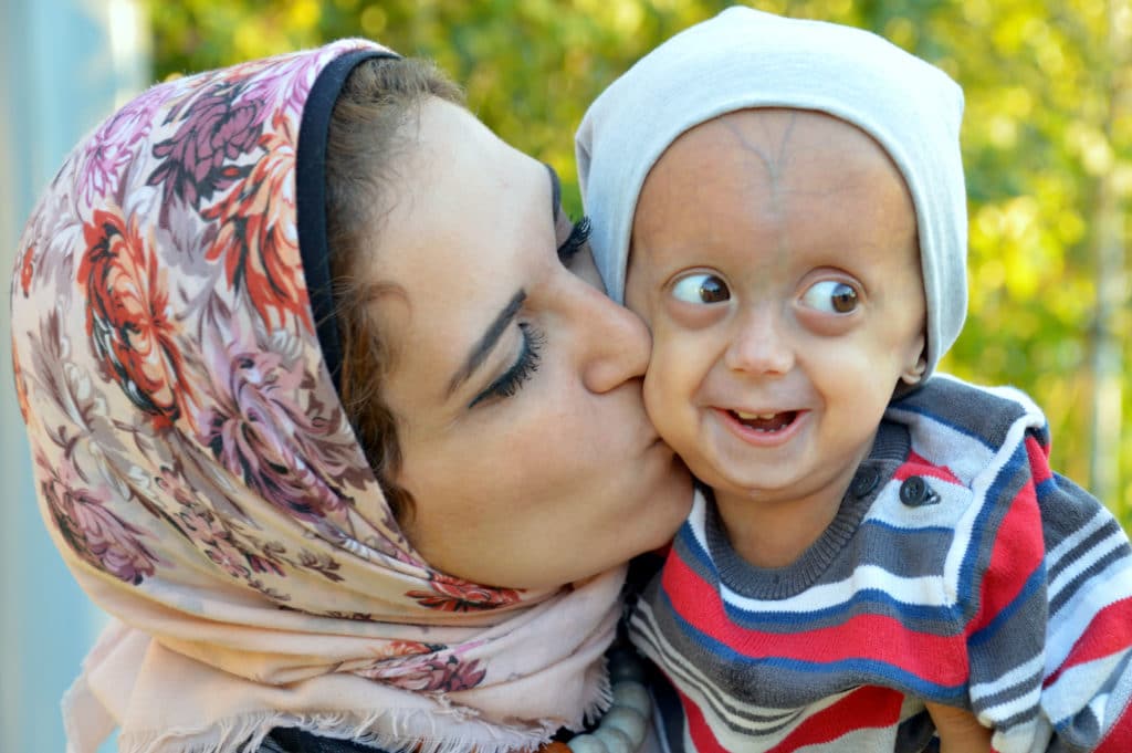 zein and mom, progeria patient